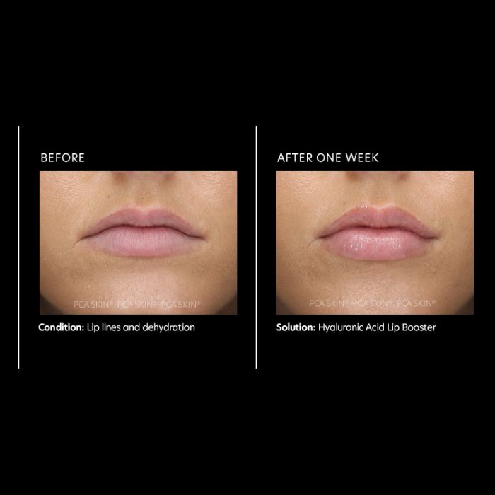 PCA SKIN Hyaluronic Acid Lip Booster