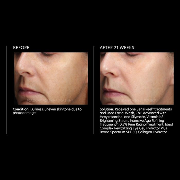 PCA SKIN Vitamin b3 Brightening Serum
